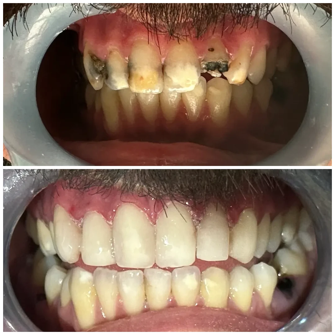 Cosmetic Dental Services