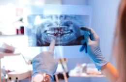 The Ultimate Guide to Your Dental Check Up and X Ray for a Perfect Smile