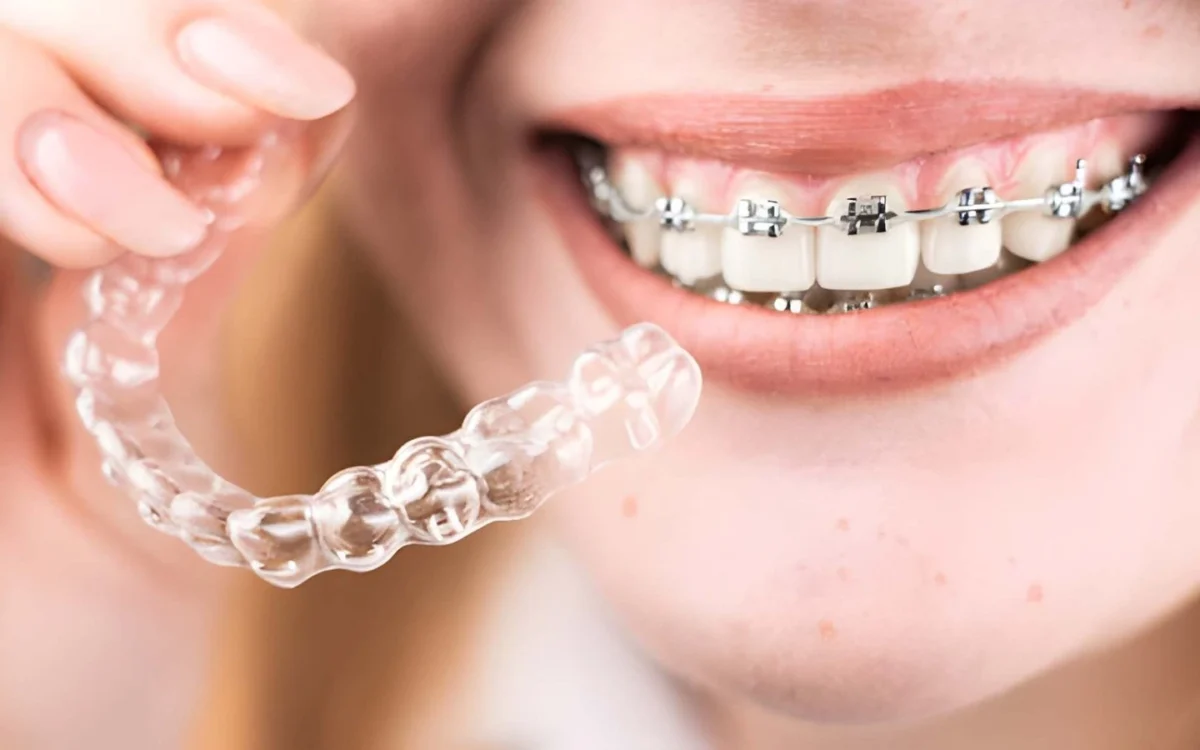 Braces in Islamabad