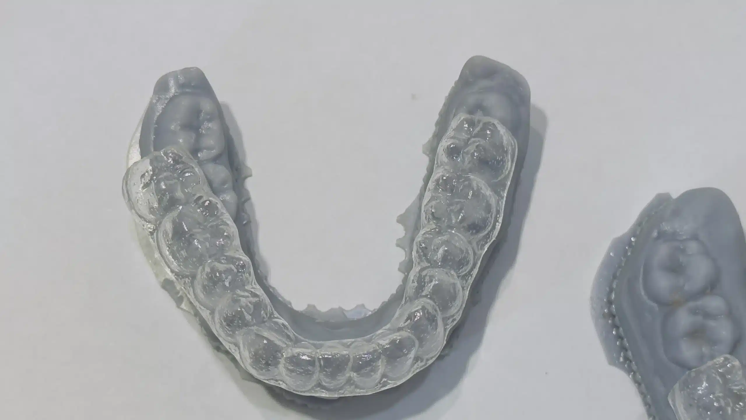 Teeth Grinding, Night Guards, And TMJ Treatment In Islamabad