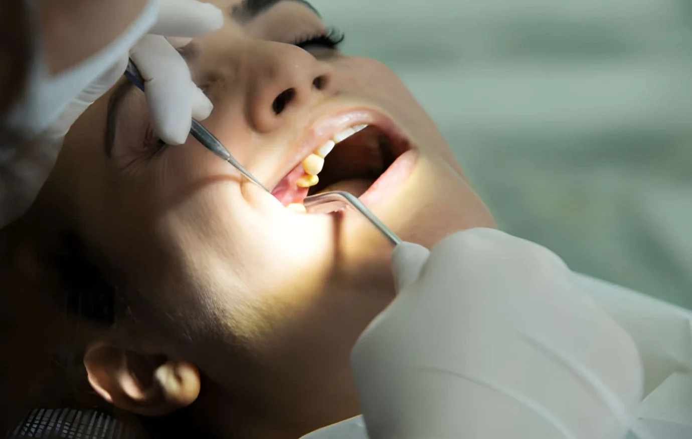 Teeth Cleaning in Islamabad Teeth Cleaning in Islamabad