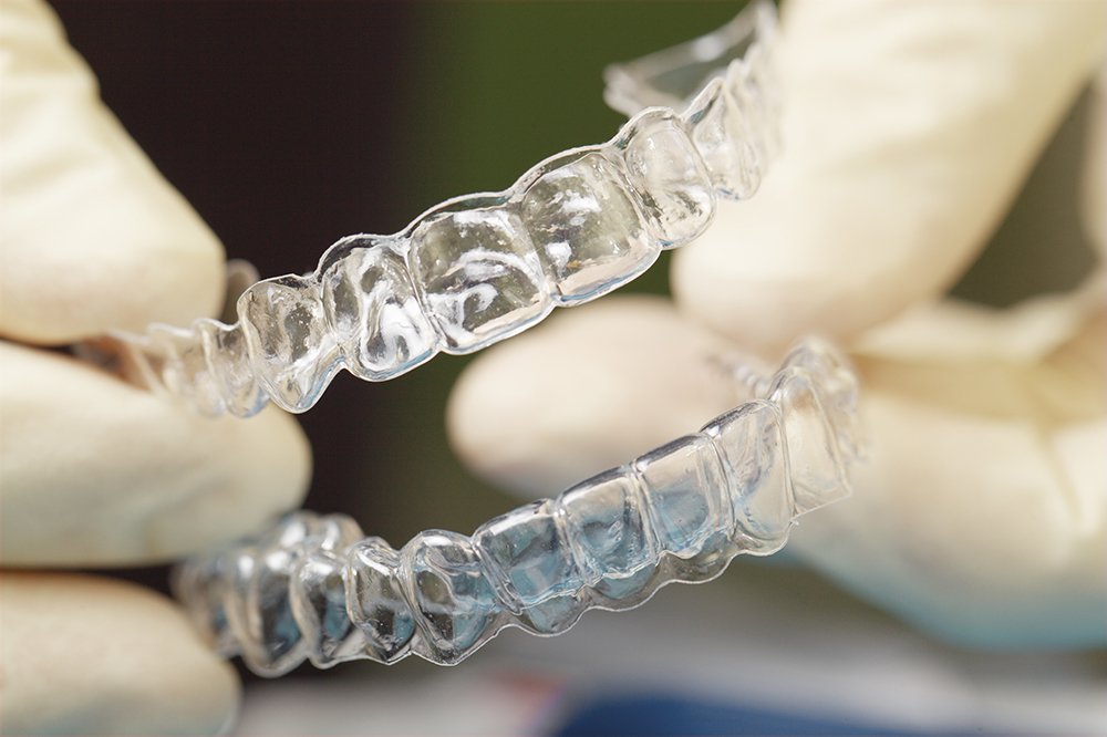 Best Clear Aligners Treatment in Islamabad | The Urban Dentist