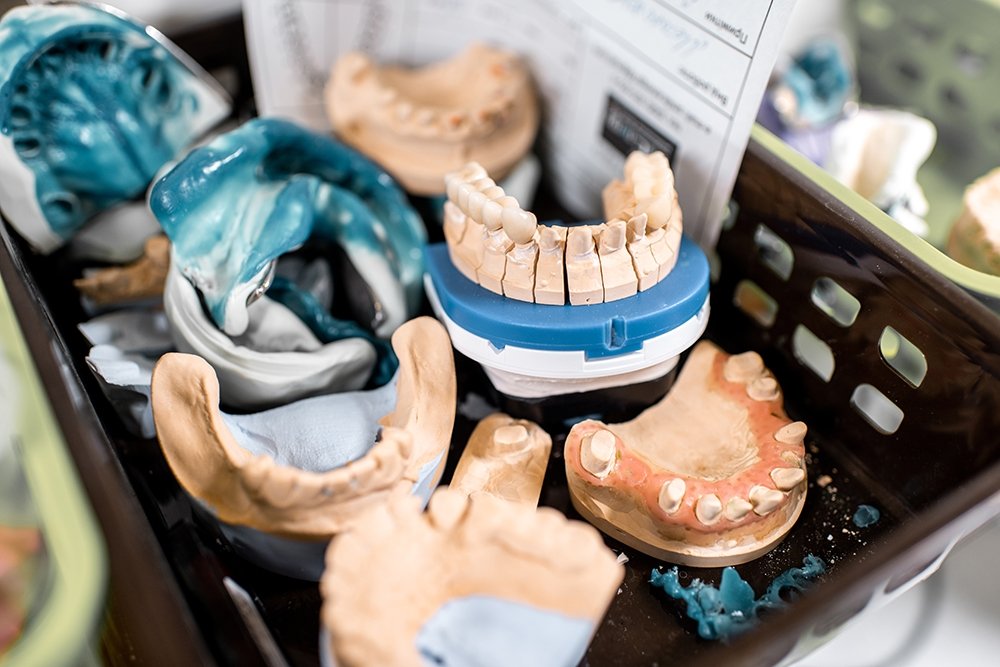 Best Dental Crowns (Caps) in Islamabad | The Urban Dentist