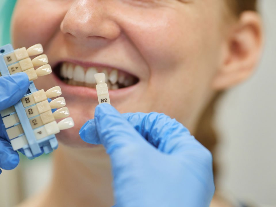 Best Dental Implants in Islamabad | The Urban Dentist