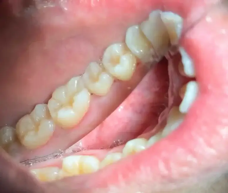 dental check up