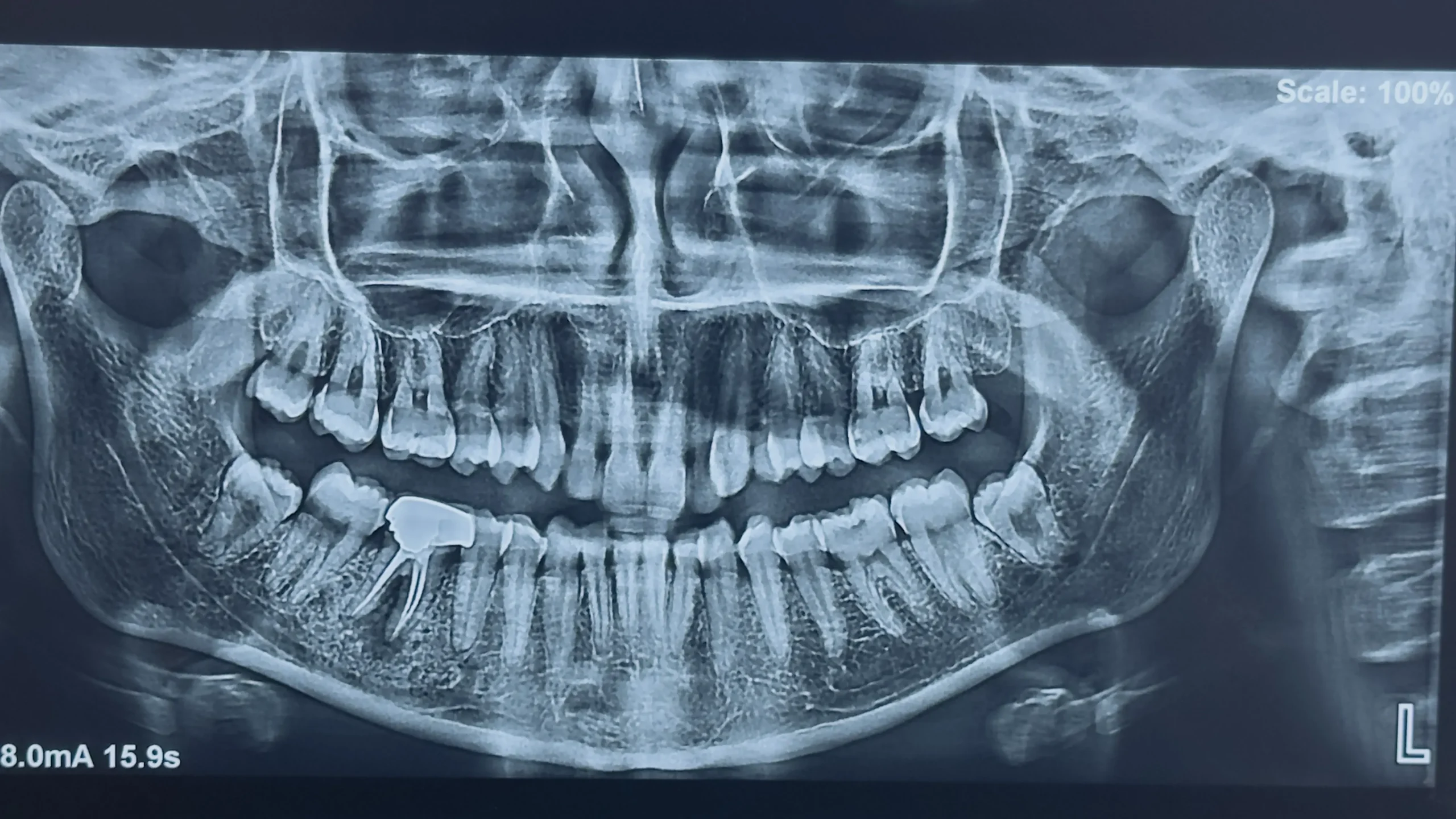 dental x ray
