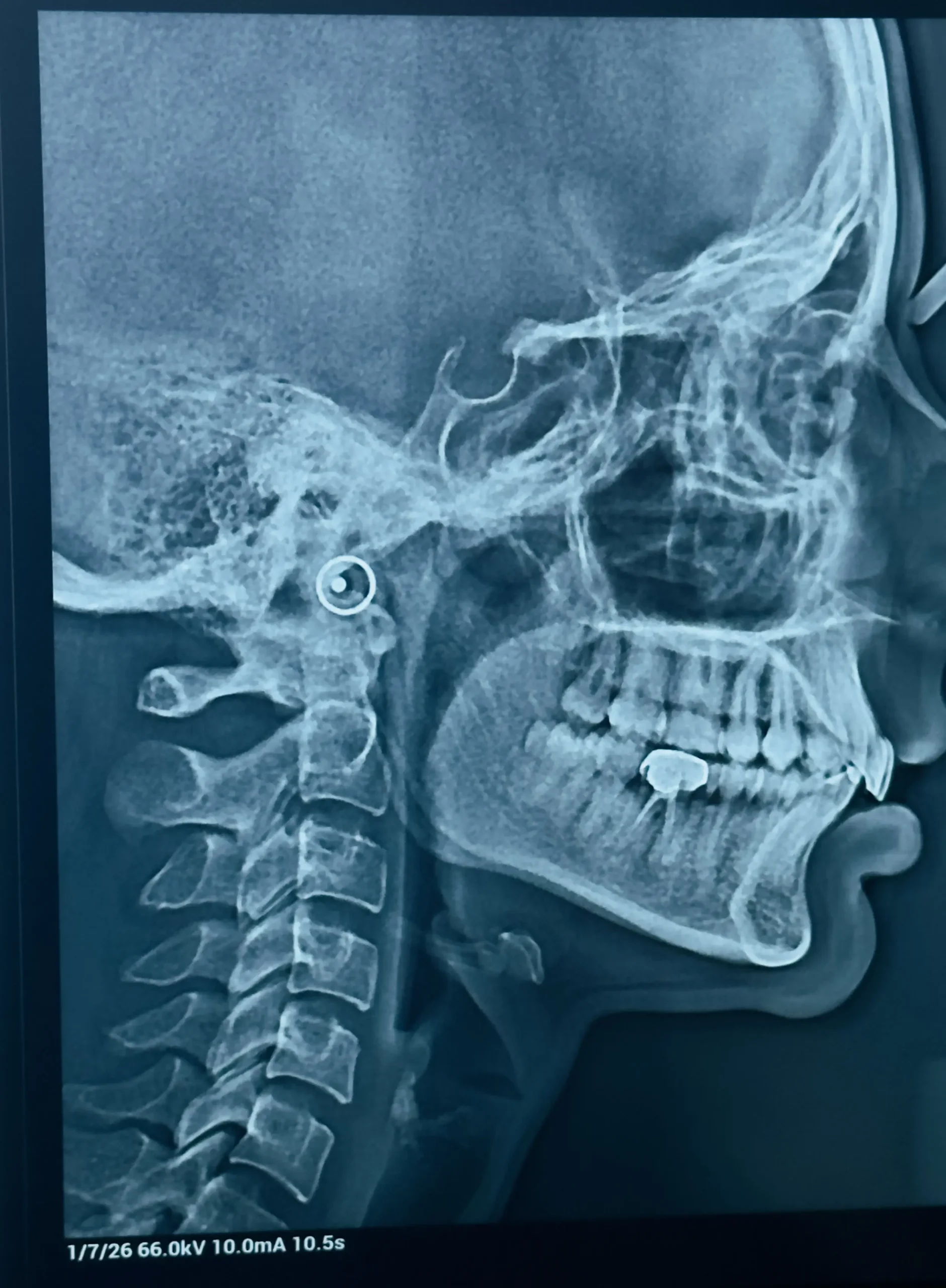 dental xray